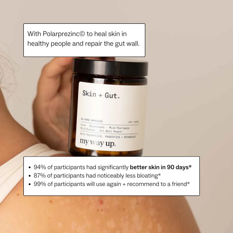 my way up Complete Skin Clear System
