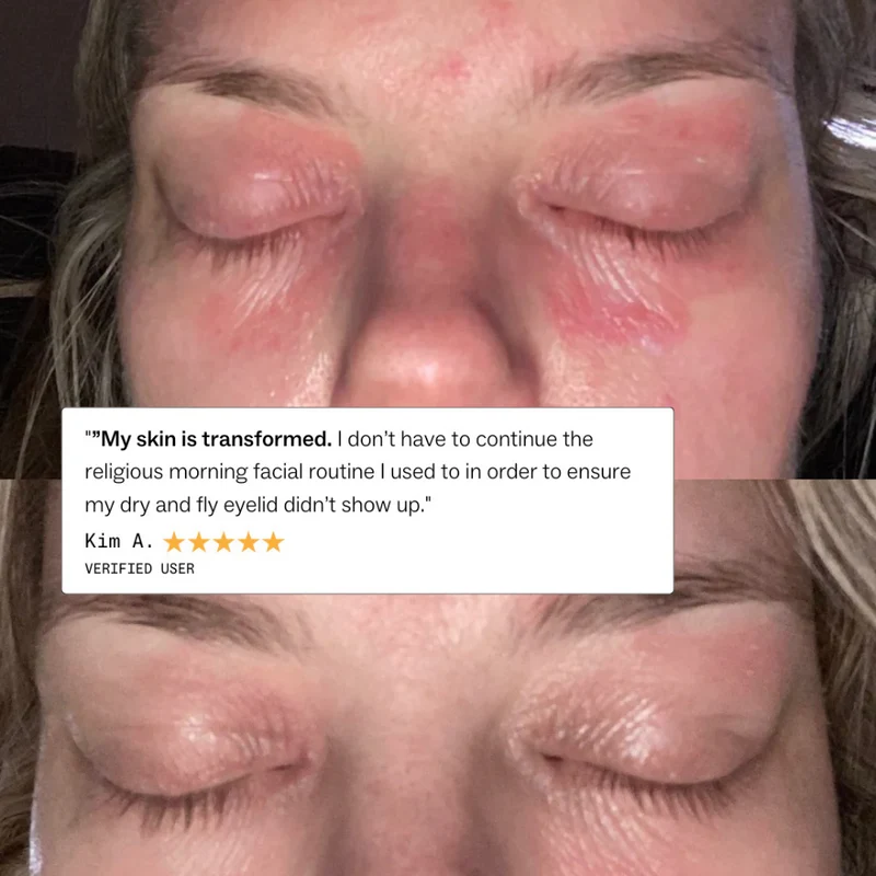 my way up Complete Skin Clear System