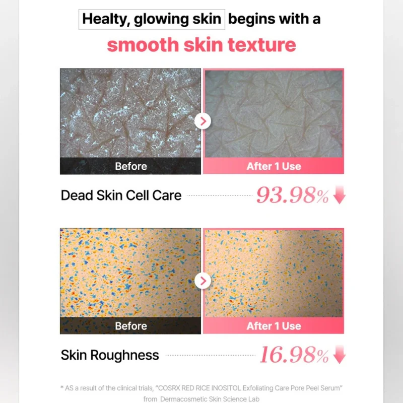COSRX Red Rice Inositol Exfoliating Care Pore Peel Serum 80ml