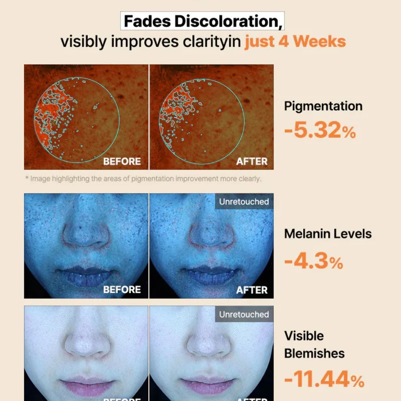 COSRX The Alpha-Arbutin Discoloration Care Hydrogel Mask - 3pcs