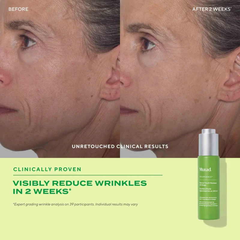 Murad Retinol Youth Renewal Face Oil Drops 30ml