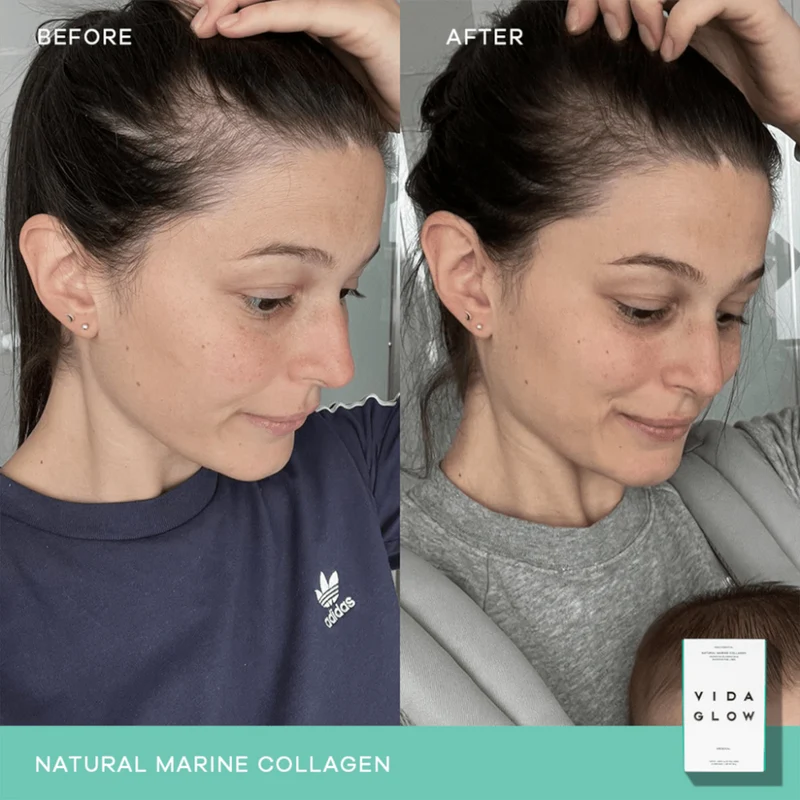 Vida Glow Natural Marine Collagen 30x3g Sachets