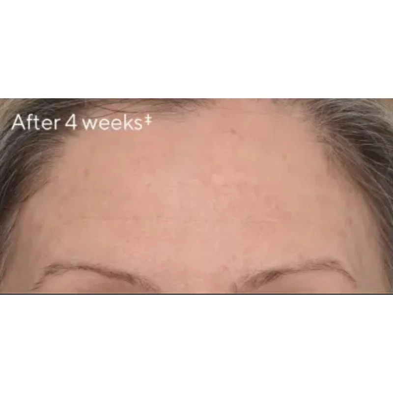 Murad Targeted Wrinkle Corrector 15ml