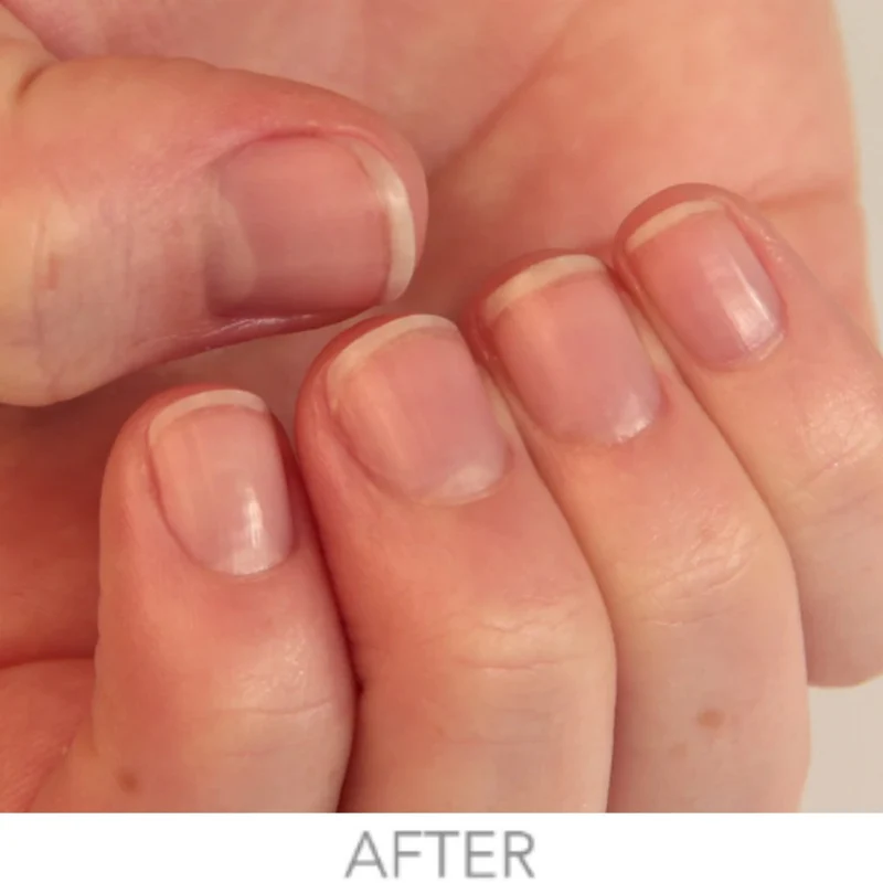 Londontown kur Crème réparatrice pour les ongles 30 ml