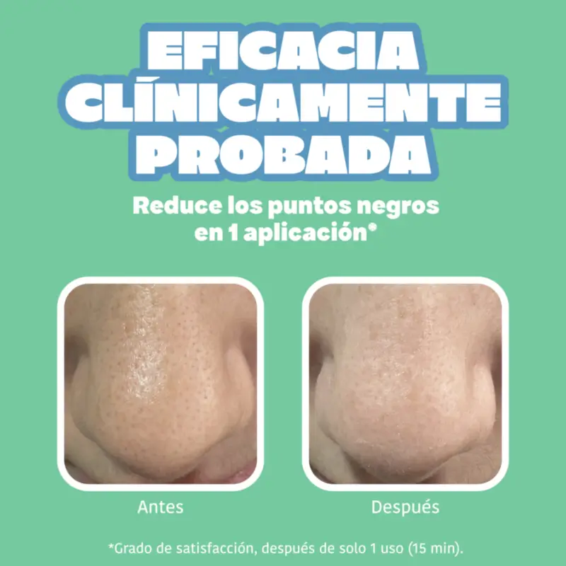 IROHA NATURE Bandelettes pour le nez BYE BYE Dirty Pores - Nettoyage en profondeur (5 pièces)
