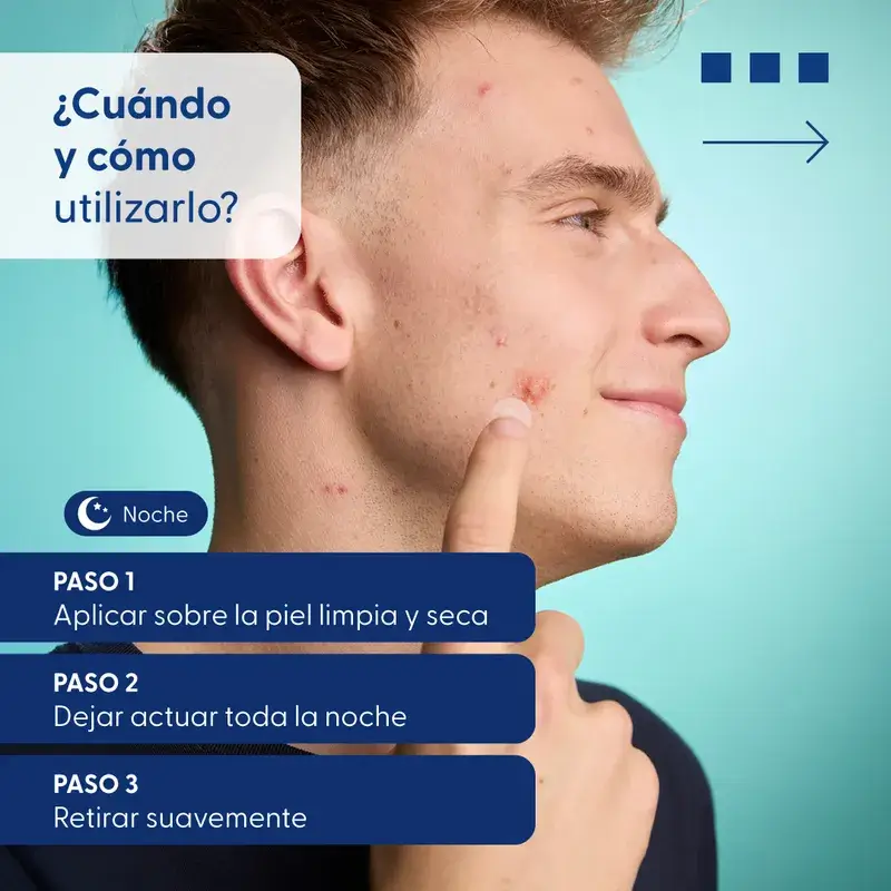 Urgo Spots Hydrocolloid Patches Micro Needling, 9 unités